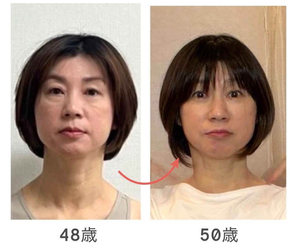 骨格セルフケア講座